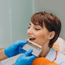 The Lifespan of Dental Veneers: How Long Do They Last?