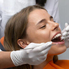 What Causes Tooth Decay to Reappear After a Filling?
